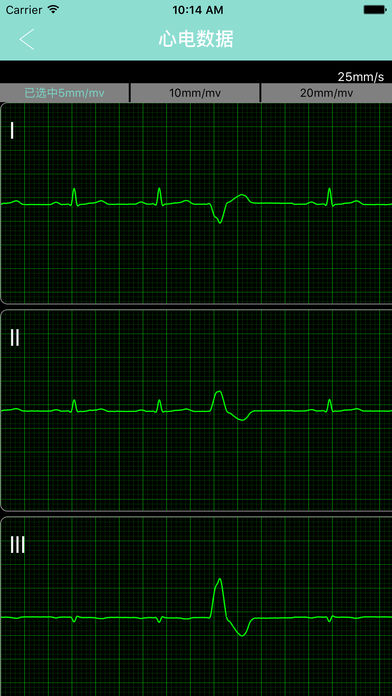 找心电专家手机软件app截图
