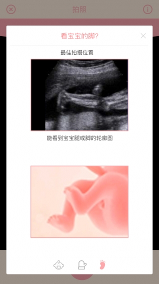 胎儿相机手机软件app截图