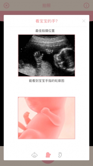 胎儿相机手机软件app截图