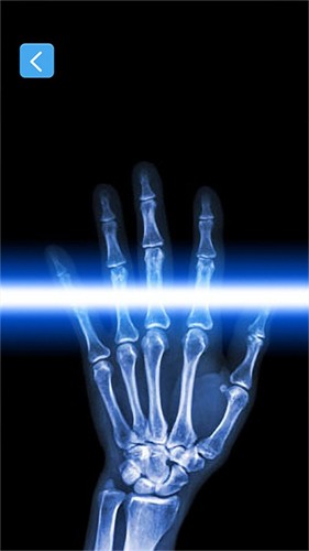 X射线模拟器手游app截图