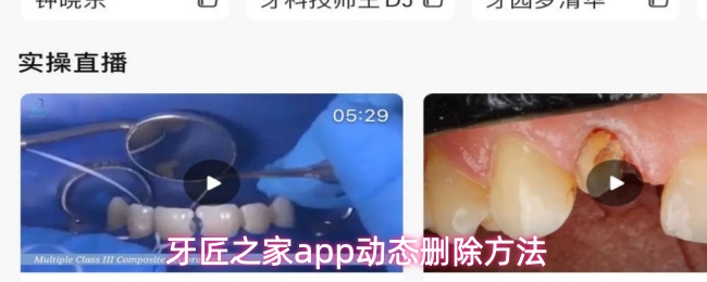 牙匠之家app动态删除方法