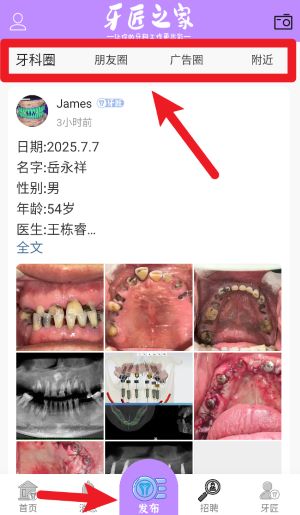 牙匠之家app使用说明